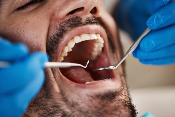 Best Emergency Dental Care for Broken or Chipped Teeth in Huntsville, AR